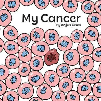 My Cancer, Paperback/Angus Olsen