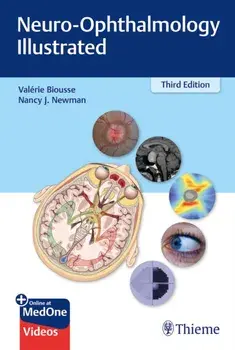 Neuro-Ophthalmology Illustrated. 3 New edition, Paperback/Nancy Newman