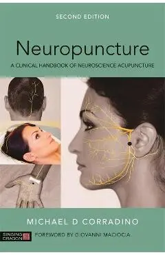 Neuropuncture