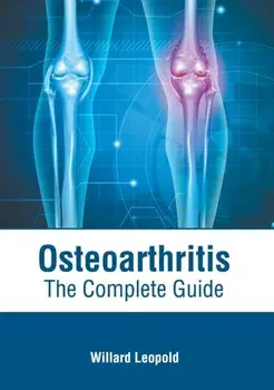 Osteoarthritis: The Complete Guide, Hardcover/Willard Leopold