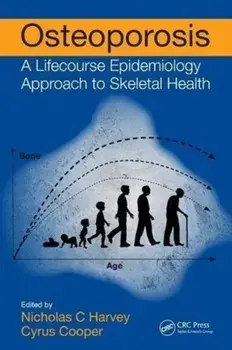 Osteoporosis. A Lifecourse Epidemiology Approach to Skeletal Health, Paperback/***