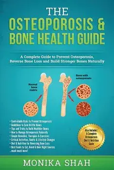 Osteoporosis: The Osteoporosis & Bone Health Guide: A Complete Guide to Prevent Osteoporosis, Reverse Bone Loss and Build Stronger B, Paperback/Monika Shah