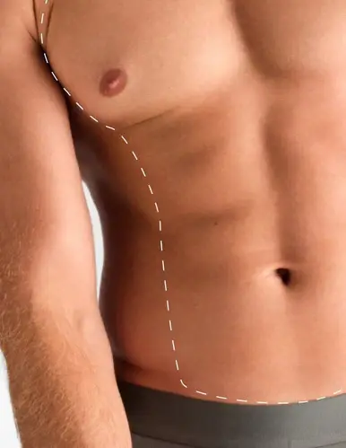 Pachet Laser Bărbați: Piept & Abdomen - 8 Sedinte