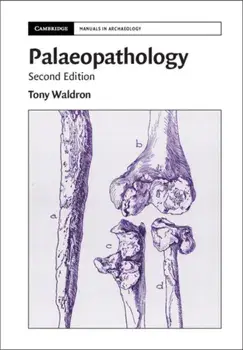 Palaeopathology, Paperback/Tony Waldron