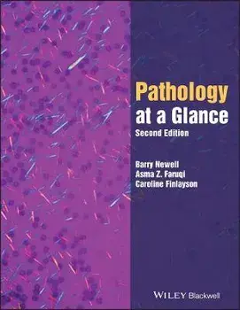 Pathology at a Glance 2nd Edition, Paperback/B Newell
