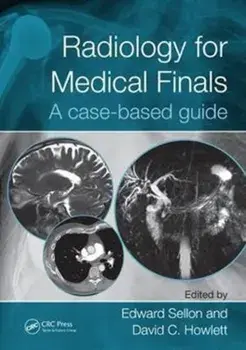 Radiology for Medical Finals. A case-based guide, Paperback/***