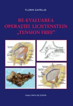 Re-evaluarea operatiei Lichtenstein "tension free"/Florin Gavrilas