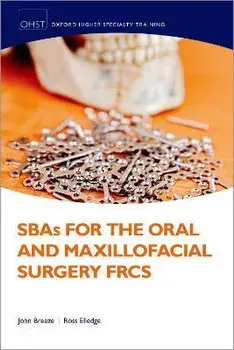 SBAs for the Oral and Maxillofacial Surgery FRCS, Paperback/***