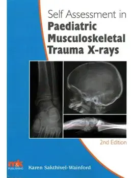 Self-Assessment in Paediatric Musculoskeletal Trauma X-Rays. 2 Revised edition, Paperback/Karen Sakthivel-Wainford