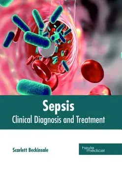 Sepsis: Clinical Diagnosis and Treatment, Hardcover/Scarlett Beckinsale