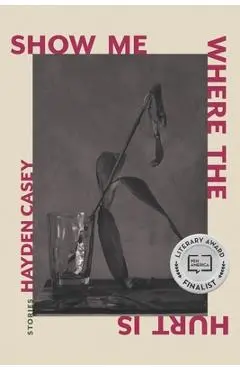 Show Me Where the Hurt Is: Stories - Hayden Casey