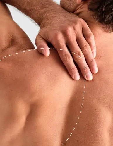 Spate 1/4 – Epilare Definitivă cu Laser - 4 Sedinte
