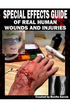 Special Effects Guide Of Real Human Wounds and Injuries: Special Effects Guide Of Real Human Wounds and Injuries - Benito Garcia Iii