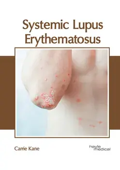 Systemic Lupus Erythematosus, Hardcover/Carrie Kane