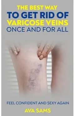 The Best Way to Get Rid of Varicose Veins Once and For All: Feel Confident and Sexy Again: Feel confident and sexy again - Ava Sams