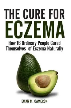 The Cure for Eczema, Hardcover/Ewan M. Cameron