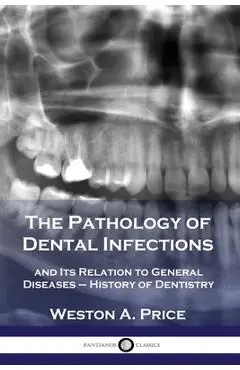 The Pathology of Dental Infections: and Its Relation to General Diseases - History of Dentistry - Weston A. Price