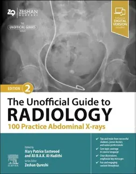 The Unofficial Guide to Radiology: 100 Practice Abdominal X-rays. 2 ed, Paperback/***