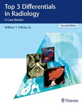 Top 3 Differentials in Radiology. A Case Review, Hardback/William T. O'Brien
