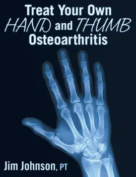 Treat Your Own Hand and Thumb Osteoarthritis, Paperback/Jim Johnson