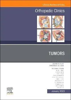 Tumors, An Issue of Orthopedic Clinics, Hardback/***