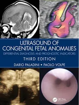Ultrasound of Congenital Fetal Anomalies. Differential Diagnosis and Prognostic Indicators, 3 ed, Hardback/Paolo Volpe