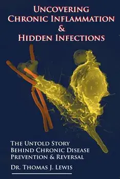 Uncovering Chronic Inflammation & Hidden Infections: The Untold Story Behind Chronic Disease Prevention & Reversal, Paperback/Thomas J. Lewis Phd