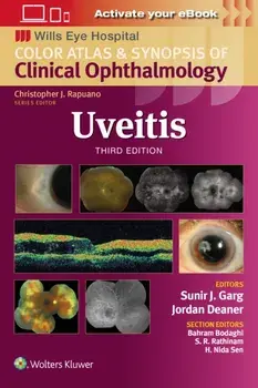 Uveitis. 3 ed, Paperback/Sunir J. Garg