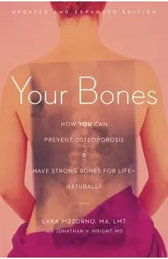 Your Bones: How You Can Prevent Osteoporosis & Have Strong Bones for Life - Naturally - Lara Pizzorno