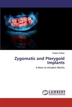 Zygomatic and Pterygoid Implants, Paperback/Wasim Pathan